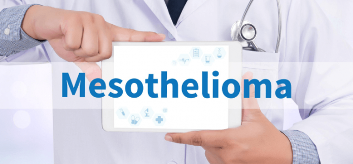 Mesothelioma-Lawyers-In-Chicago