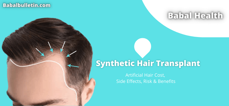 Synthetic-Hair-Transplant